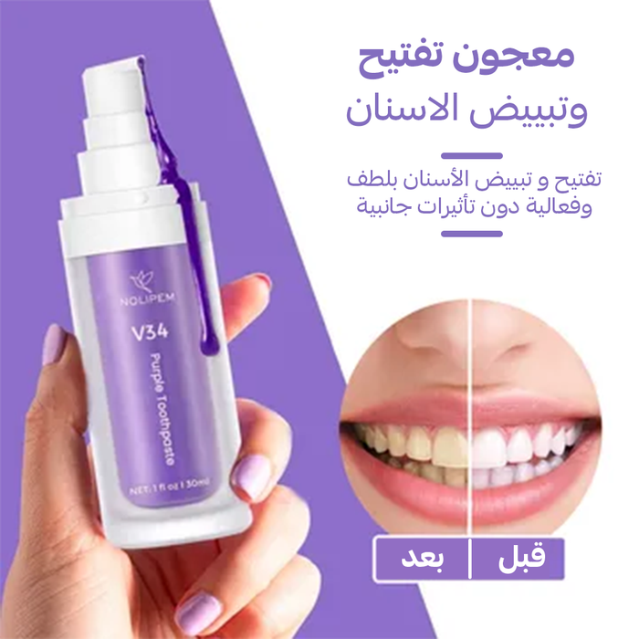 جل تبييض الأسنان – لابتسامة بيضاء وانتعاش يدوم